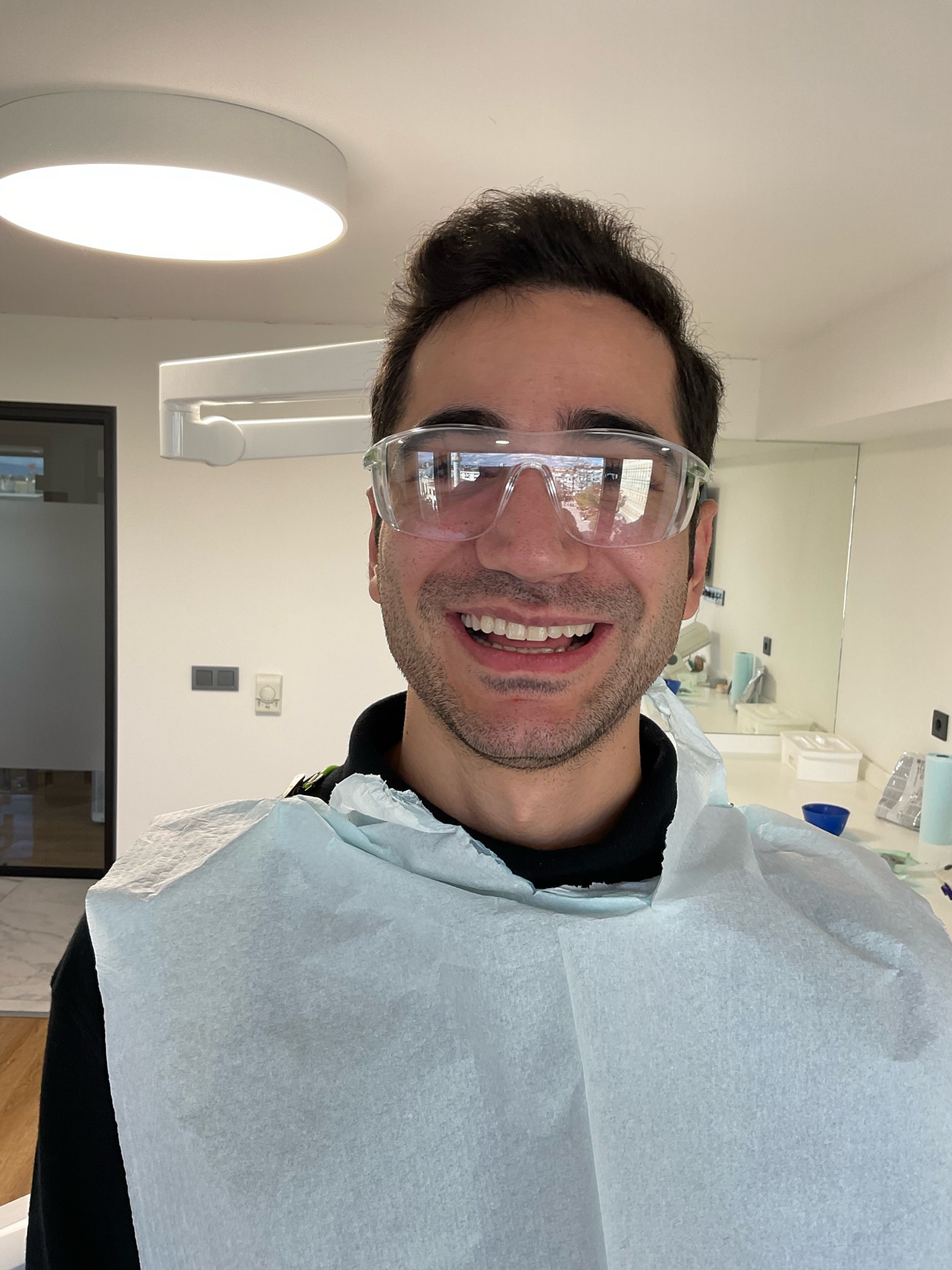 Porcelain Veneers - Before Treatment