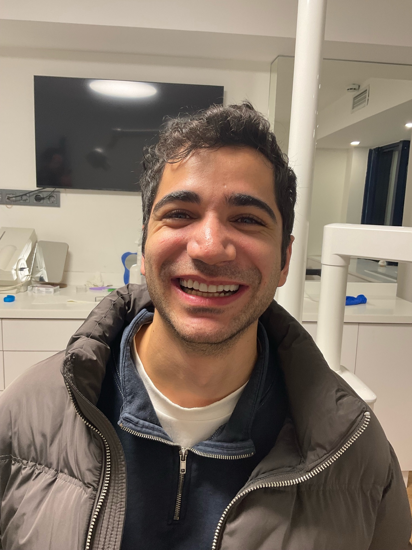 Porcelain Veneers - Final Result